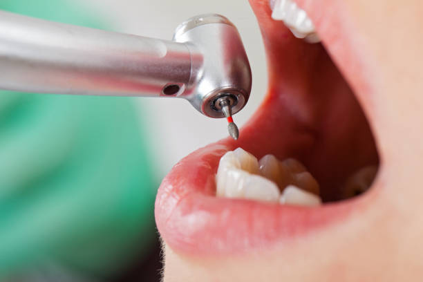 Best Emergency Broken Tooth Repair in Lakeview, MI